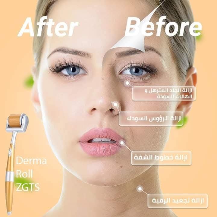 ZGTS Derma Roller – Micro‑Needling Skin & Hair Therapy - ديرمارولر – تجديد البشرة والشعر بالميكرونيدلينج